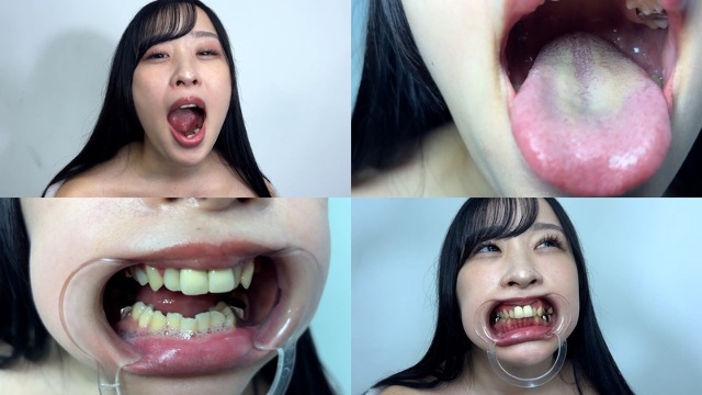 Observation of Yuno-chan's mouth with a cute throat