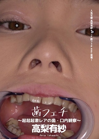 [Tooth Fetish-Ultra-ultra-ultra-rare tooth / oral observation-Arisa Takanashi]
