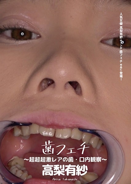 歯フェチ 〜超超超激レアの歯・口内観察〜 高梨有紗